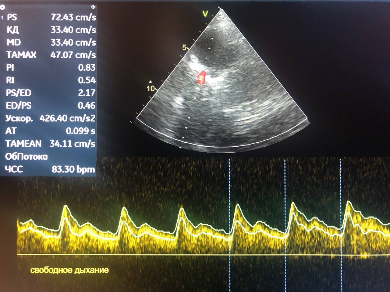 свободное дыхание.jpg