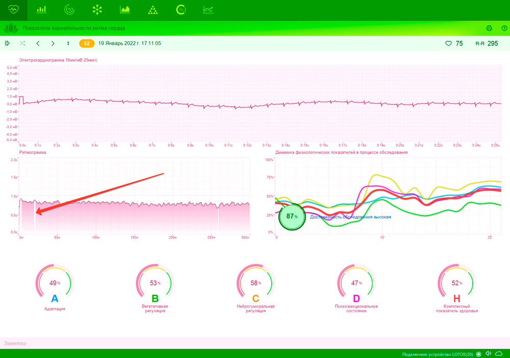 2022-01-22_09-05-17.jpg
